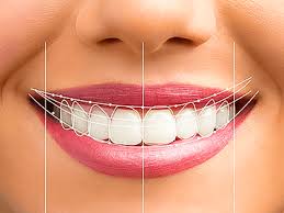 Smile designing treatment in Lucknow at Truemax Dental Clinic